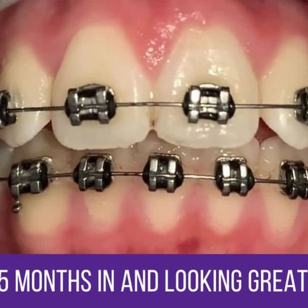 Home Rotherham Orthodontist The Orthodontic Studio