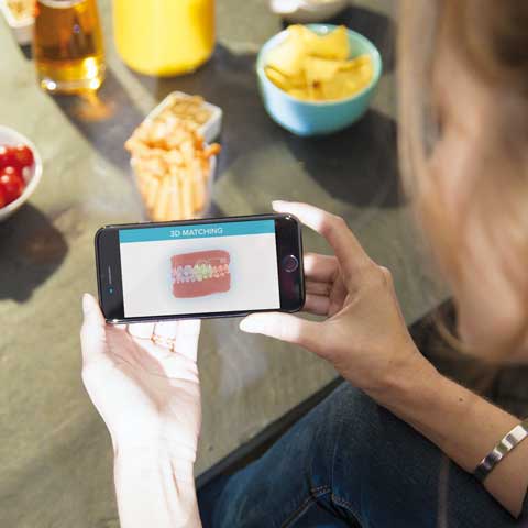 Dental Monitoring